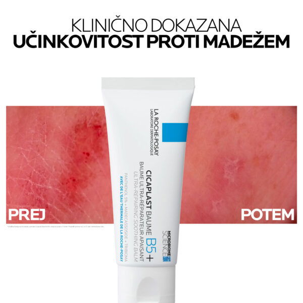 LRP CICAPLAST BAUME B5+ Ultra obnovitveni pomirjevalni balzam za razdraženo kožo, 40 ml